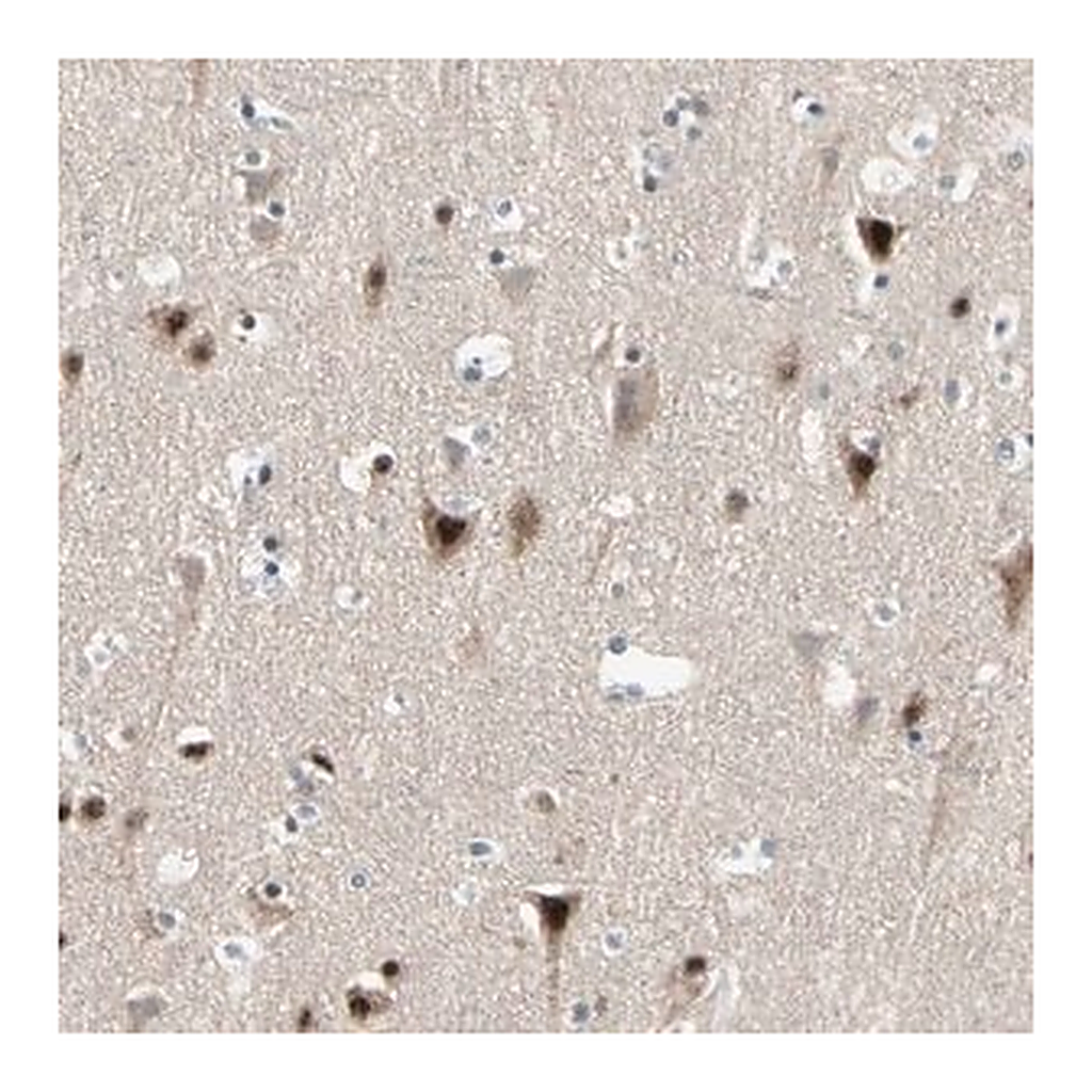 Merck Anti-MARK1 antibody produced in rabbit