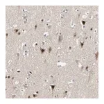 Merck Anti-MARK1 antibody produced in rabbit
