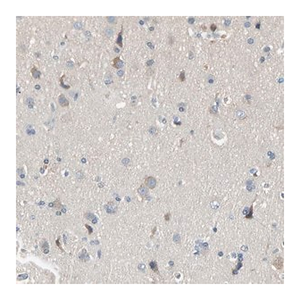 Merck Anti-MARK1 antibody produced in rabbit