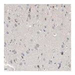 Merck Anti-MARK1 antibody produced in rabbit