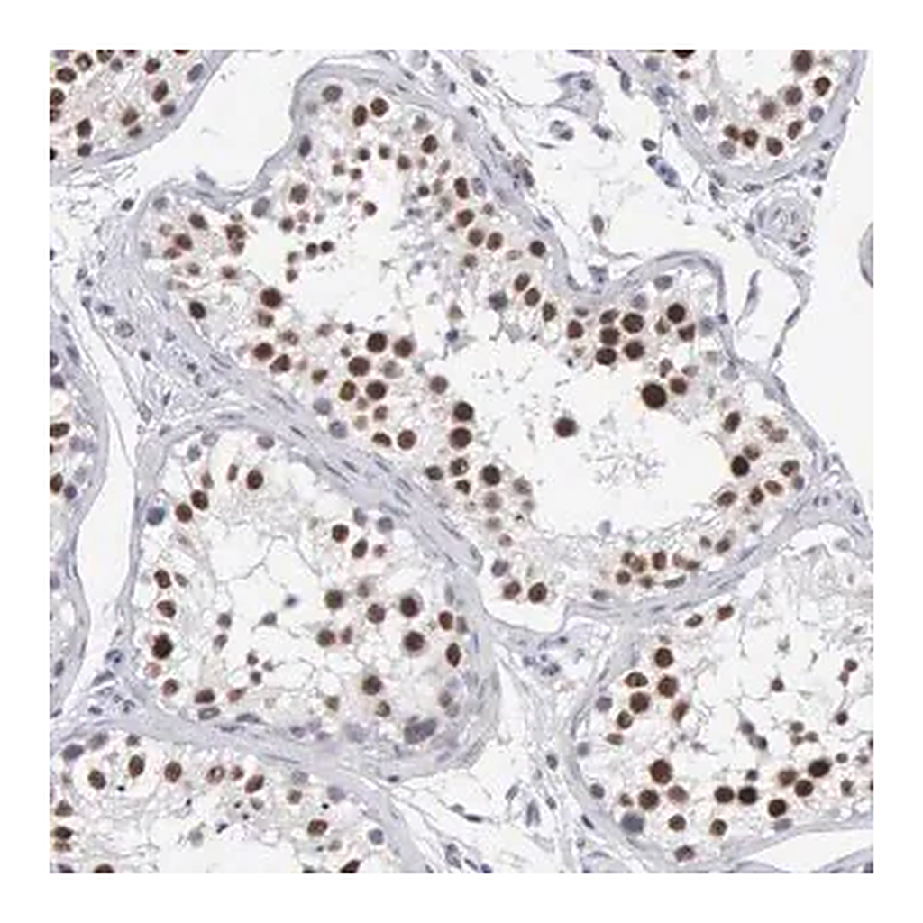 Merck Anti-MNAT1 antibody produced in rabbit