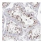 Merck Anti-MNAT1 antibody produced in rabbit