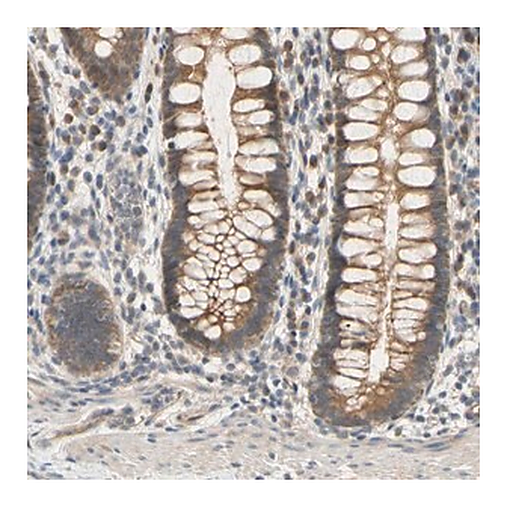 Merck Anti-MBTPS2 antibody produced in rabbit