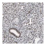 Merck Anti-MEIS2 antibody produced in rabbit