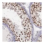 Merck Anti-PPP4R3A antibody produced in rabbit