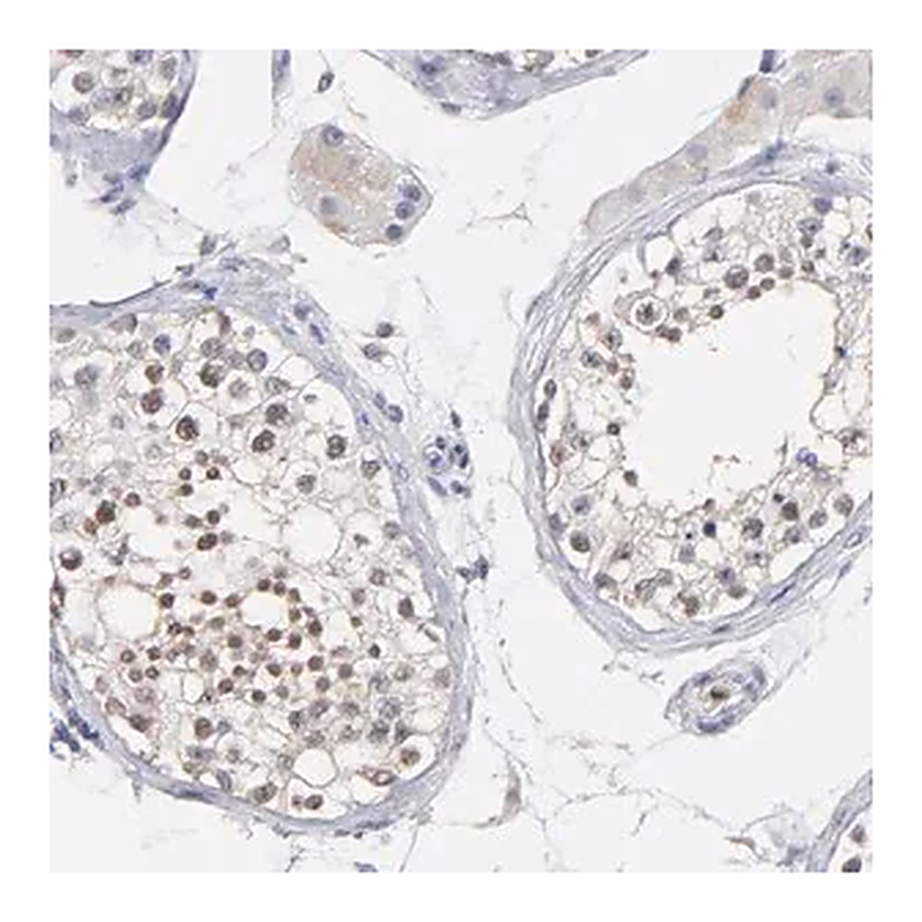 Merck Anti-SMARCA1 antibody produced in rabbit