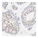 Merck Anti-SMARCA1 antibody produced in rabbit