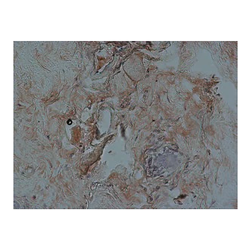 Merck Anti-FKHRL1 (FOXO3a) antibody produced in rabbit
