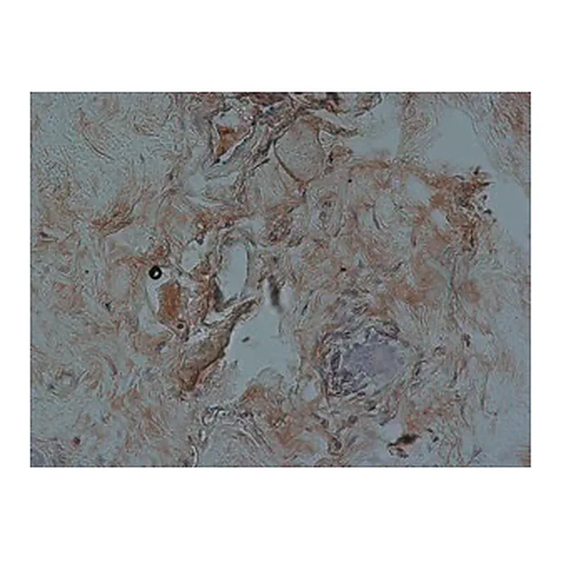 Merck Anti-FKHRL1 (FOXO3a) antibody produced in rabbit