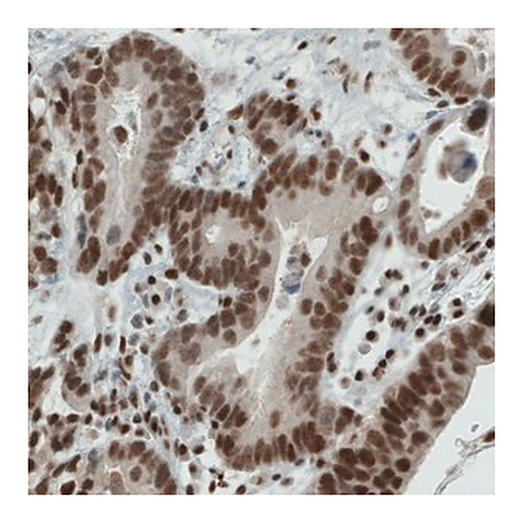 Merck Monoclonal Anti-ERCC1 antibody produced in mouse