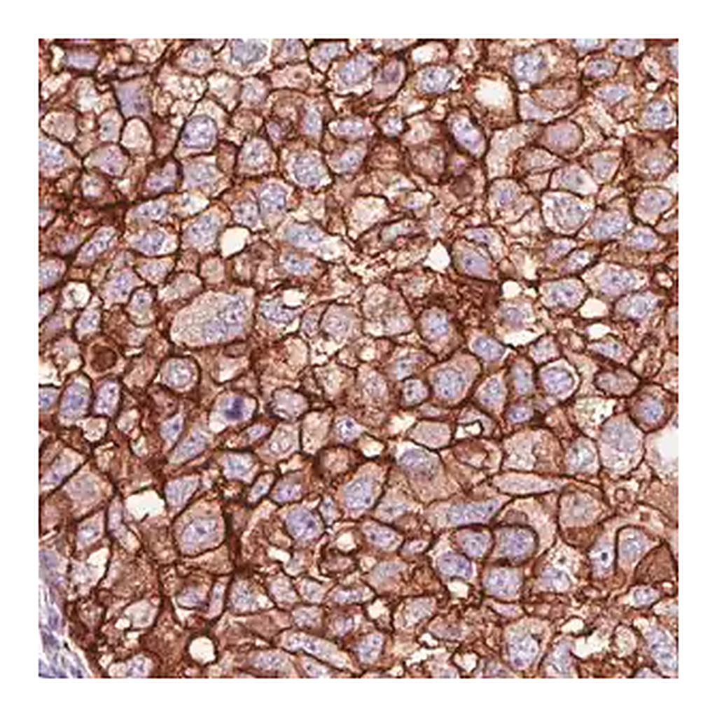 Merck Monoclonal Anti-HER2 antibody produced in mouse