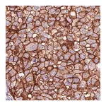 Merck Monoclonal Anti-HER2 antibody produced in mouse