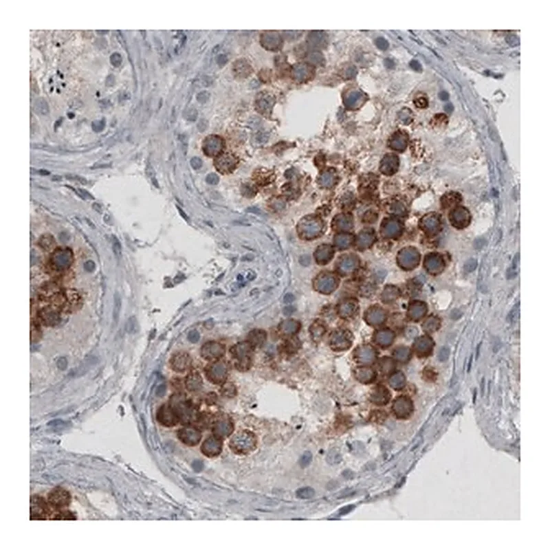 Merck Monoclonal Anti-LY6K antibody produced in mouse