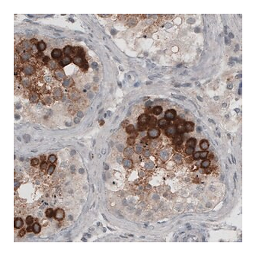 Merck Monoclonal Anti-LY6K antibody produced in mouse