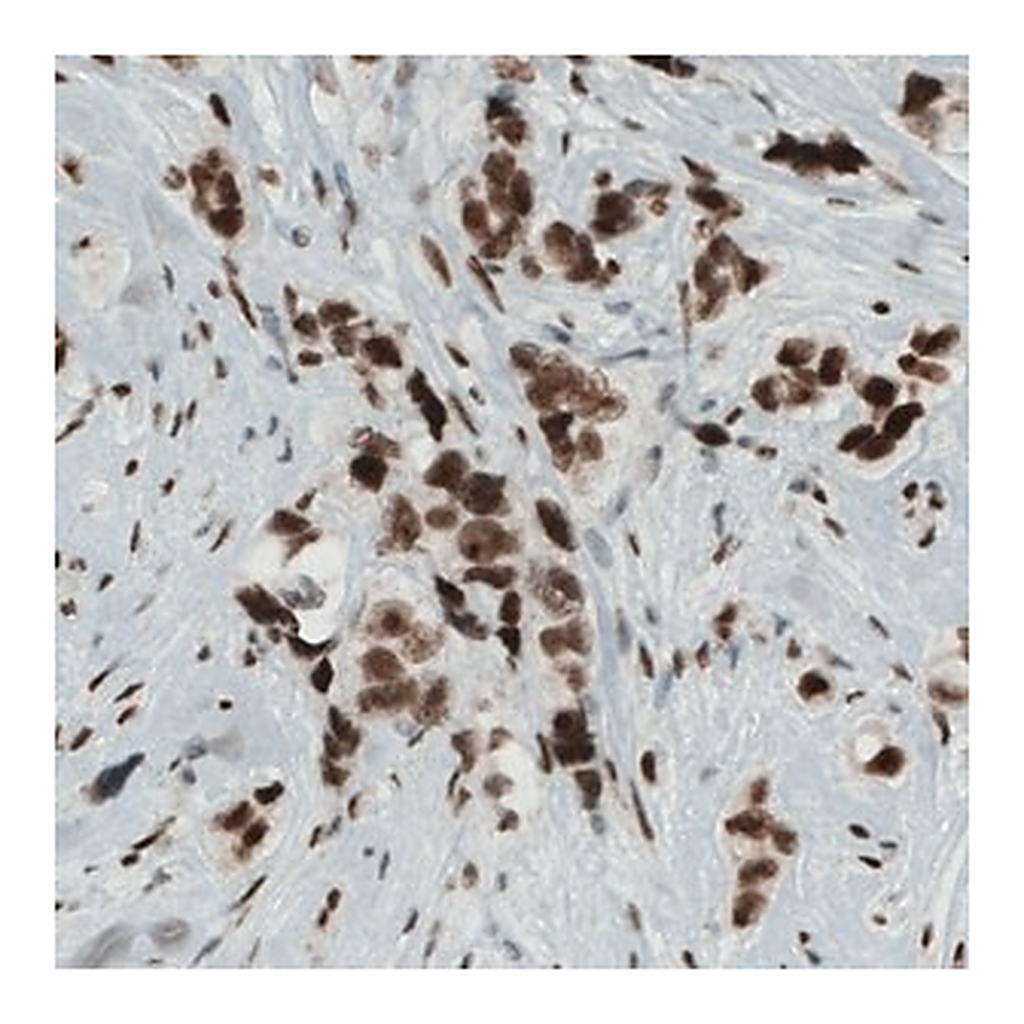 Merck Monoclonal Anti-KDM5B antibody produced in mouse