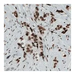 Merck Monoclonal Anti-KDM5B antibody produced in mouse