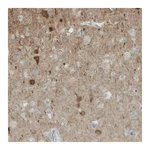 Merck Monoclonal Anti-NECAB1 antibody produced in mouse
