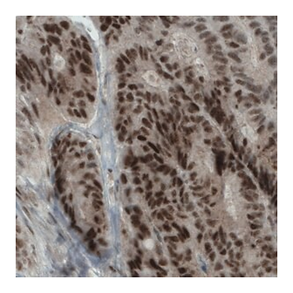 Merck Monoclonal Anti-NSD2 antibody produced in mouse