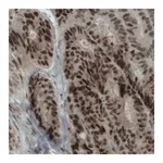Merck Monoclonal Anti-NSD2 antibody produced in mouse