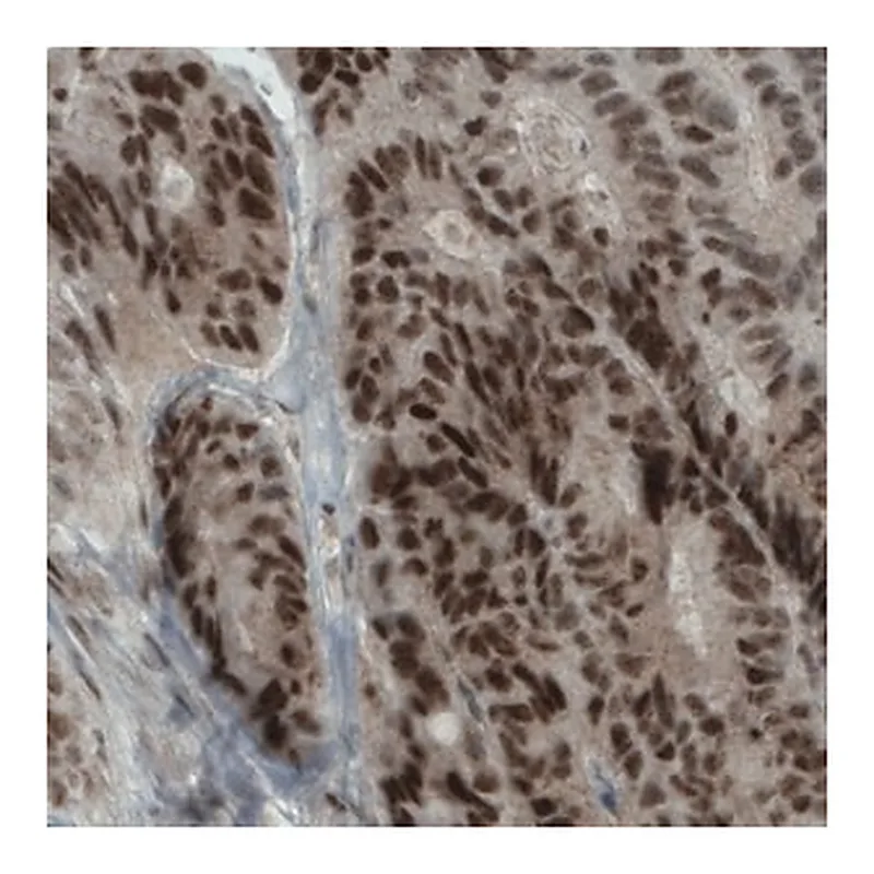 Merck Monoclonal Anti-NSD2 antibody produced in mouse