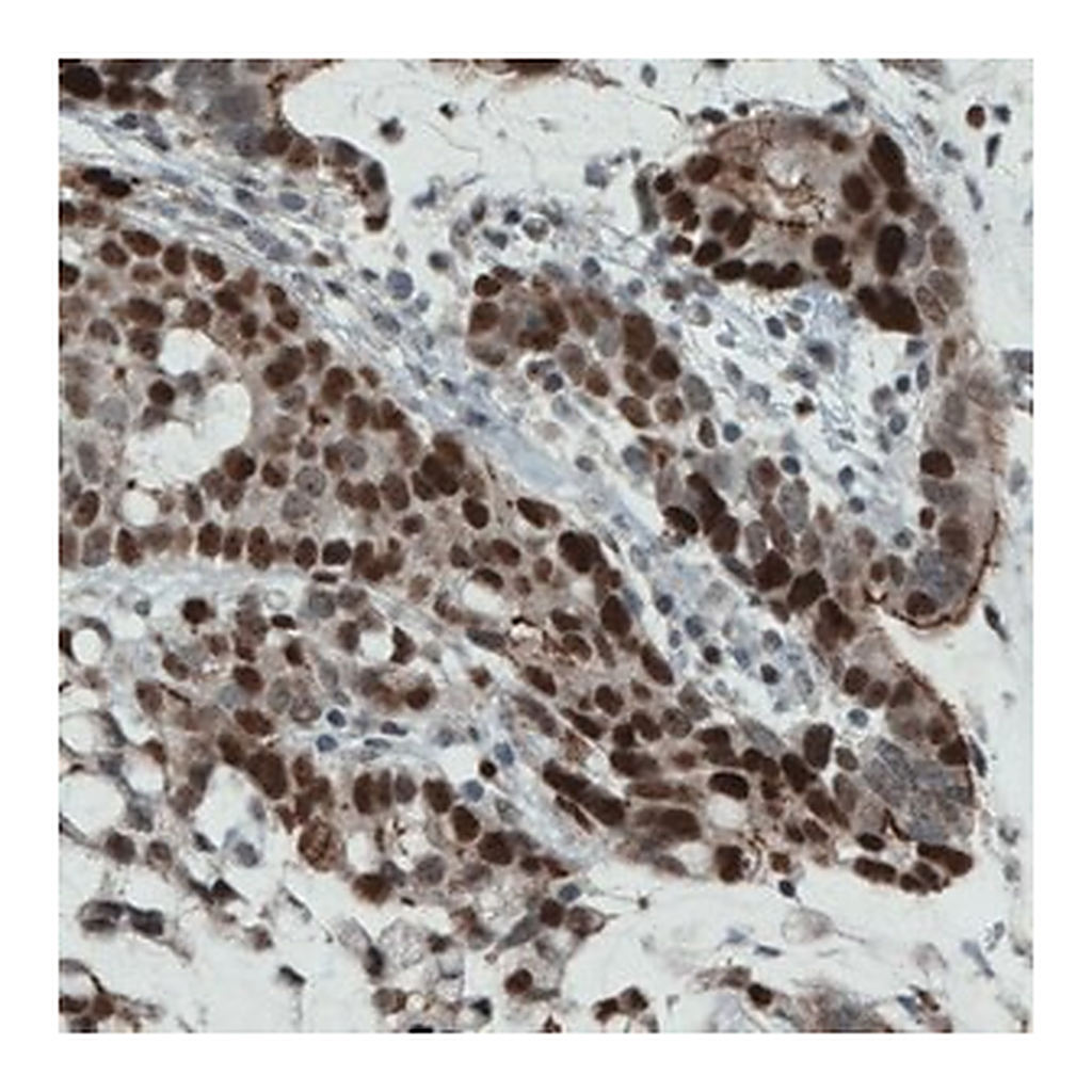 Merck Monoclonal Anti-NSD2 antibody produced in mouse
