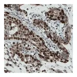 Merck Monoclonal Anti-NSD2 antibody produced in mouse