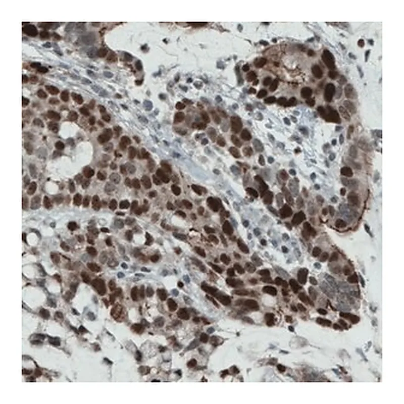 Merck Monoclonal Anti-NSD2 antibody produced in mouse