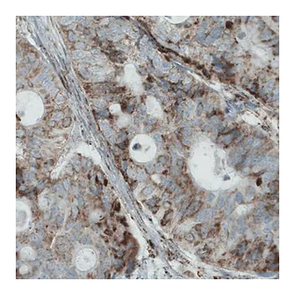 Merck Monoclonal Anti-MACC1 antibody produced in mouse