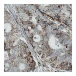 Merck Monoclonal Anti-MACC1 antibody produced in mouse