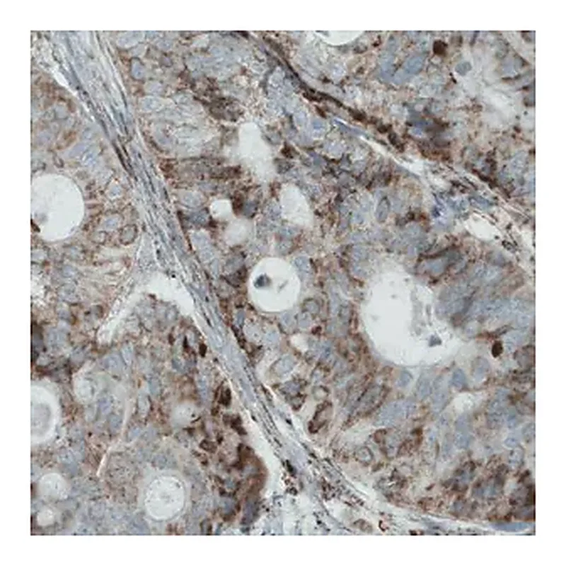 Merck Monoclonal Anti-MACC1 antibody produced in mouse