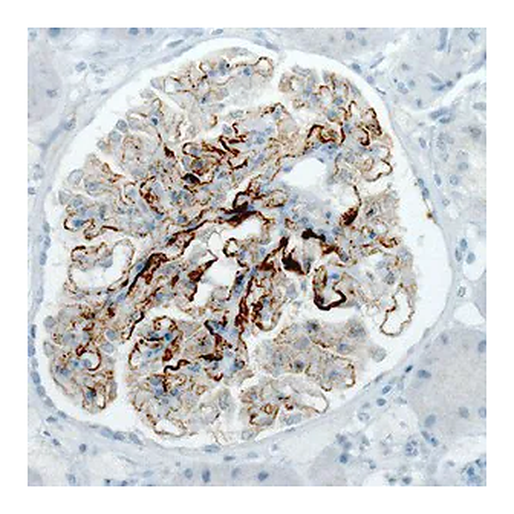 Merck Monoclonal Anti-PLA2R1 antibody produced in mouse