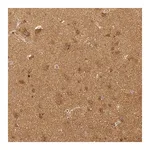 Merck Monoclonal Anti-RHOT1 antibody produced in mouse