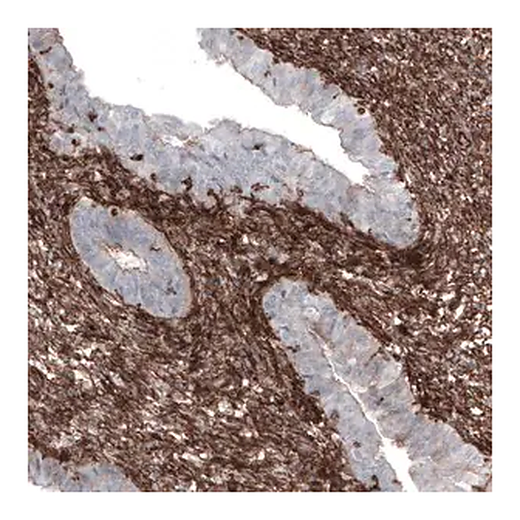 Merck Monoclonal Anti-ZYX antibody produced in mouse