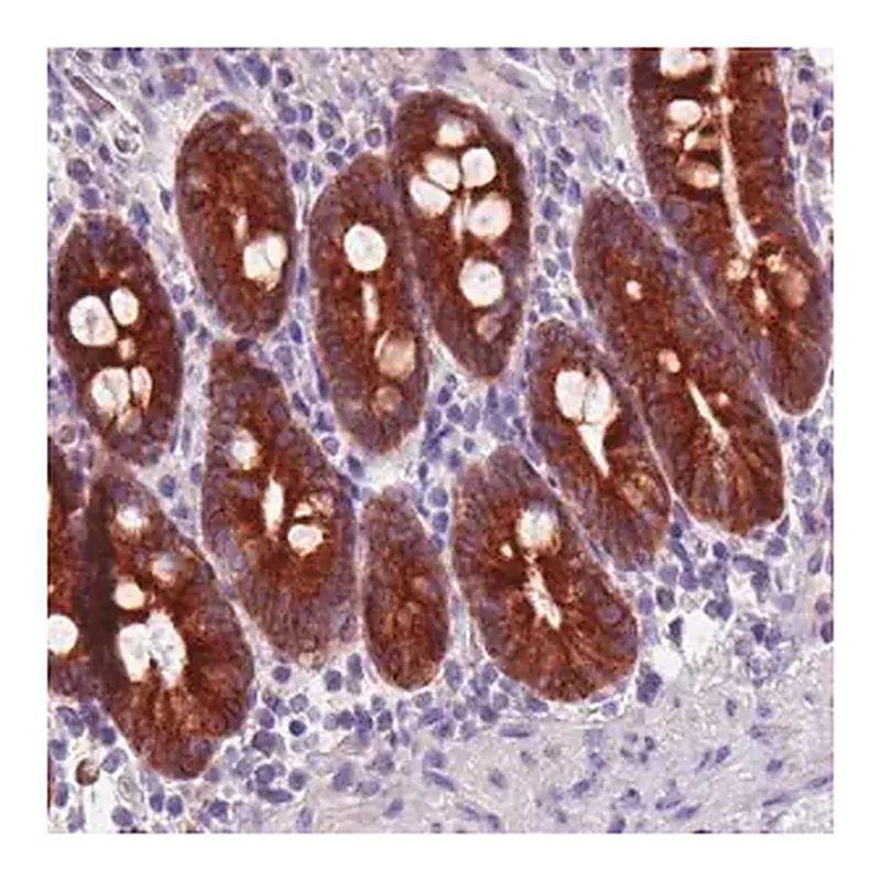 Merck Monoclonal Anti-ACSL5 antibody produced in mouse