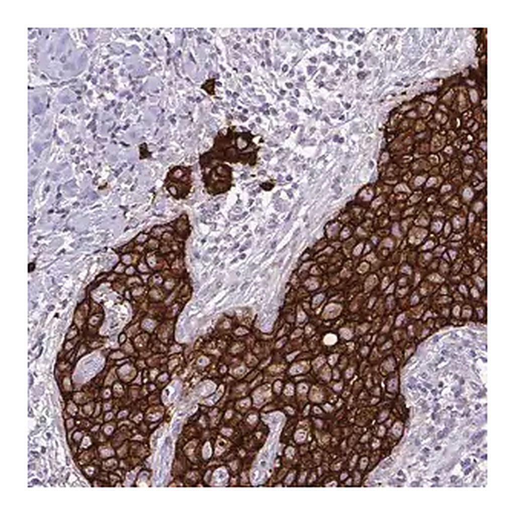 Merck Monoclonal Anti-HER2 antibody produced in mouse