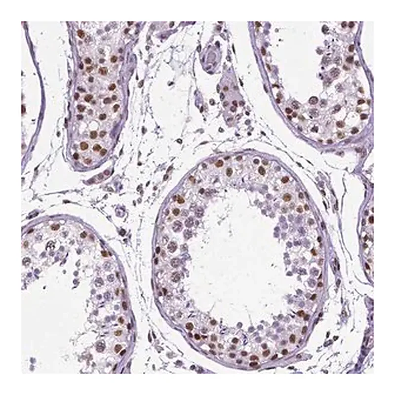 Merck Monoclonal Anti-REST antibody produced in mouse