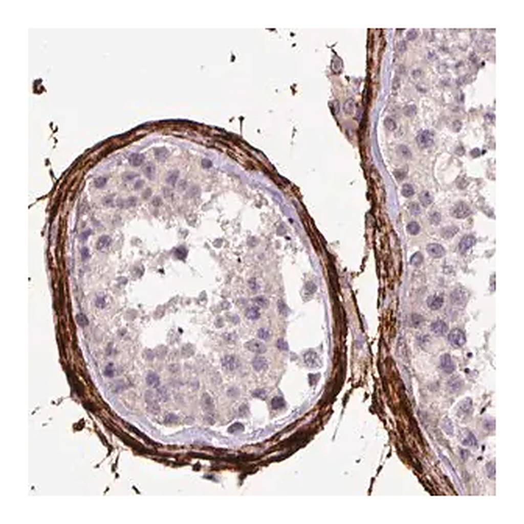 Merck Monoclonal Anti-FBN1 antibody produced in mouse
