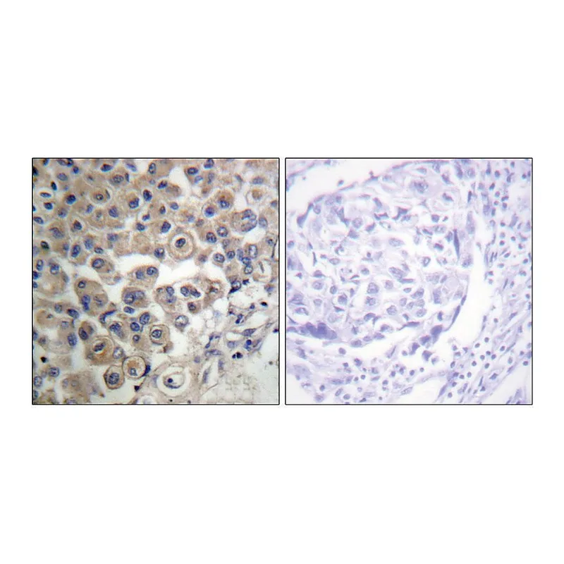 Merck Anti-PLC beta3 antibody produced in rabbit