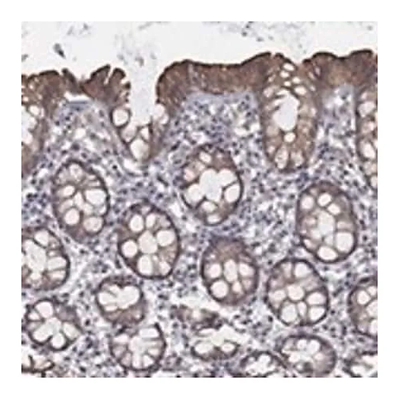 Merck Anti-CHST5 antibody produced in rabbit