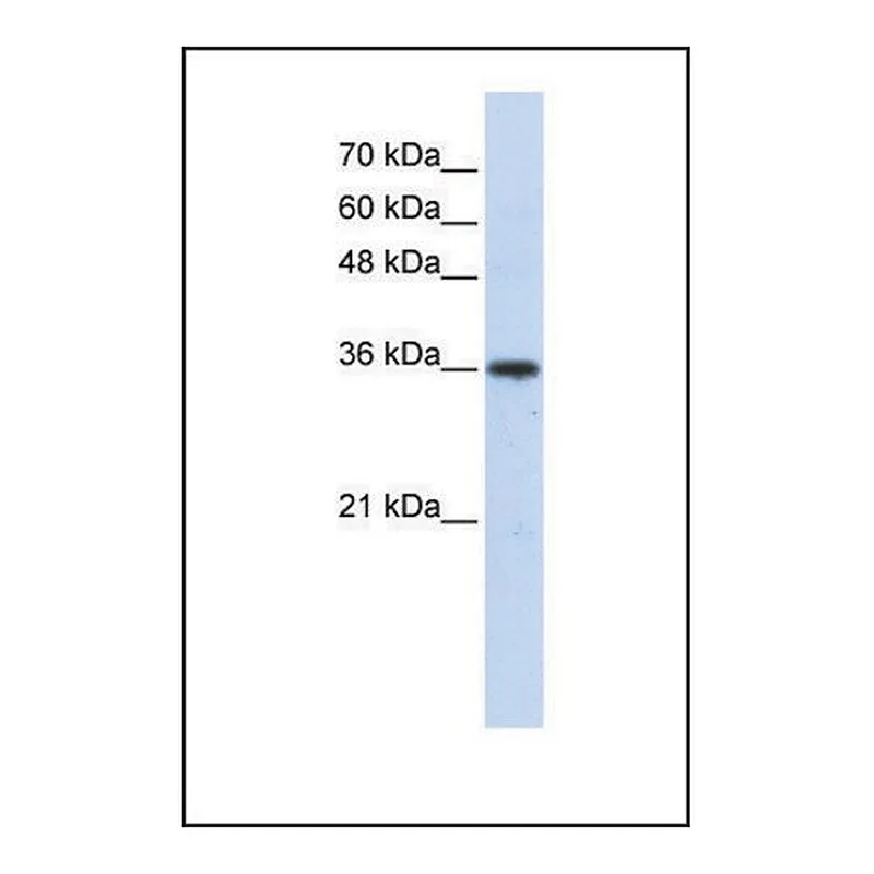 Merck Anti-AKR7A3 antibody produced in rabbit