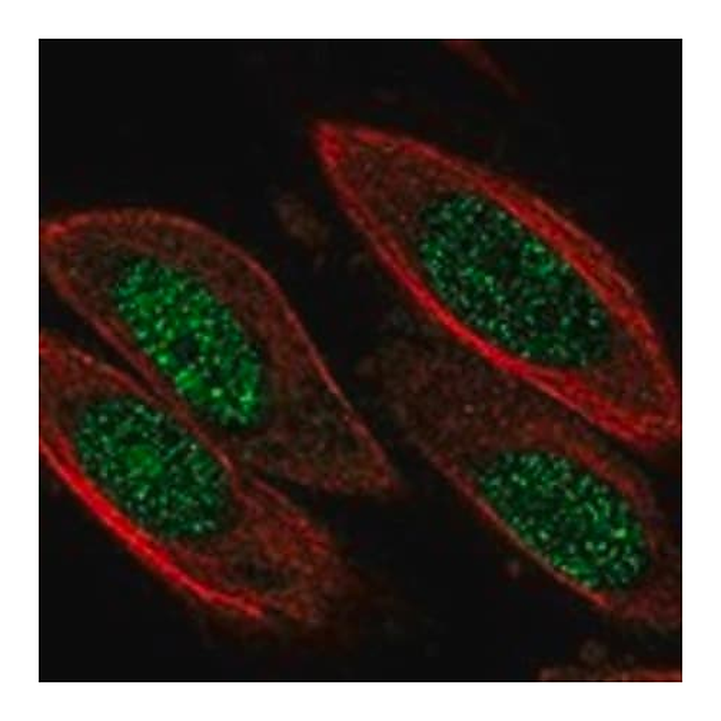 Merck Anti-CCND3 antibody produced in rabbit