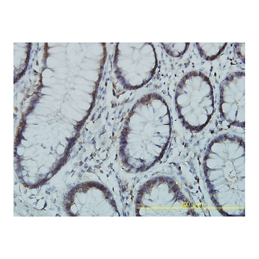 Merck Monoclonal Anti-PGM3 antibody produced in mouse