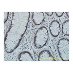 Merck Monoclonal Anti-PGM3 antibody produced in mouse