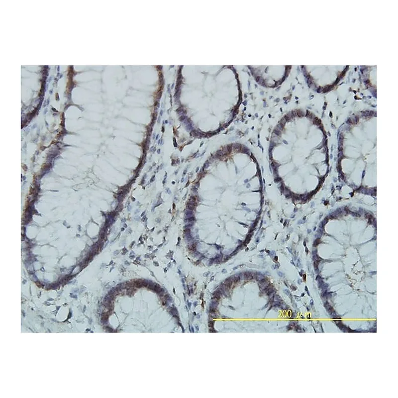 Merck Monoclonal Anti-PGM3 antibody produced in mouse
