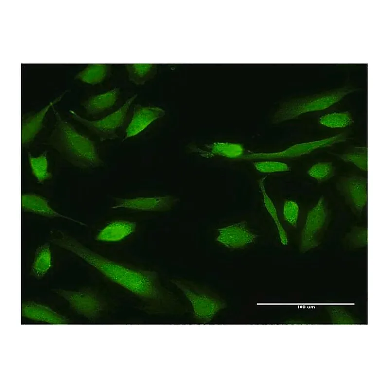 Merck Monoclonal Anti-BIRC4 antibody produced in mouse
