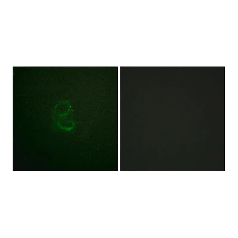 Merck Anti-IL-4R antibody produced in rabbit