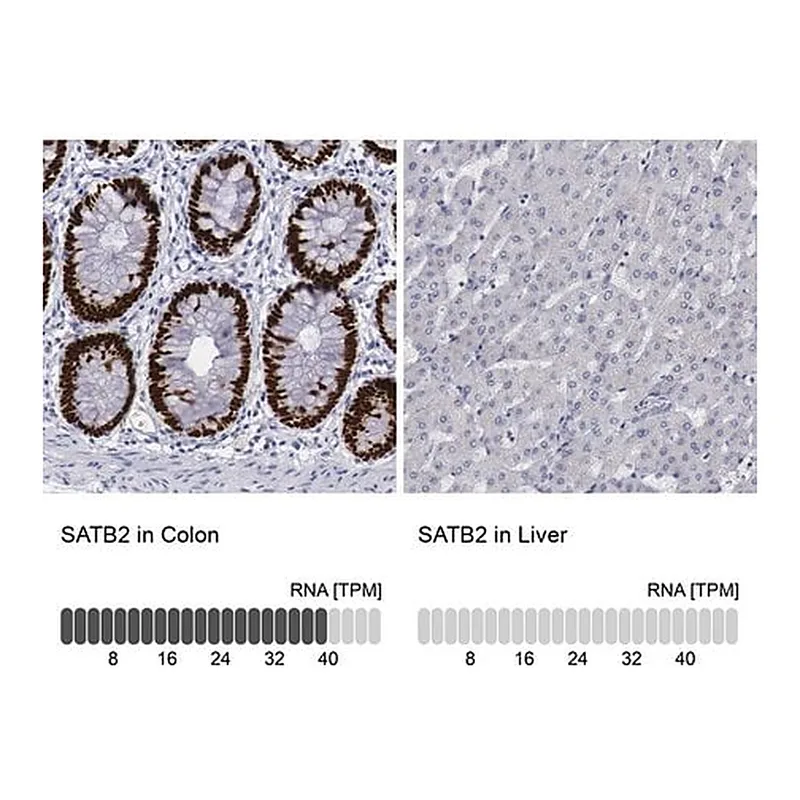 Merck Anti-SATB2 antibody produced in rabbit