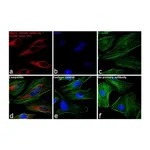 Thermo Fisher Scientific F(ab`)2-Goat anti-Rabbit IgG (H+L) Secondary Antibody, Qdot 585
