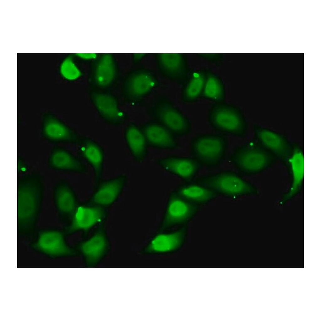 Merck Anti-TEAD1 antibody produced in rabbit
