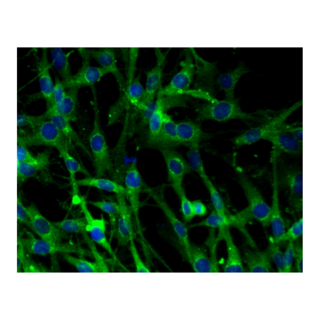 BD Purified Mouse Anti-Clathrin Heavy Chain